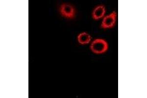 Image no. 1 for anti-serpin Peptidase Inhibitor, Clade B (Ovalbumin), Member 1 (SERPINB1) antibody (ABIN2967022)