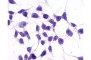 Image no. 3 for anti-Glutamate Receptor, Metabotropic 3 (GRM3) (N-Term) antibody (ABIN1048932)
