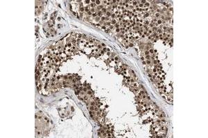 Image no. 1 for anti-Suppressor of Cancer Cell Invasion (SCAI) antibody (ABIN5573502)
