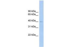 Image no. 1 for anti-Fc Receptor-Like A (FCRLA) (AA 287-336) antibody (ABIN6744875)