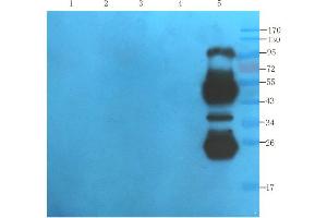 Western Blotting (WB) image for anti-IL2RA (Daclizumab Biosimilar) antibody (ABIN5668118)