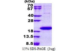 Interleukin 1 Family Member 9 (IL1F9) (AA 1-169) protein (His tag)