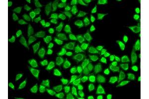 Immunofluorescence analysis of HeLa cell using IL7R antibody.