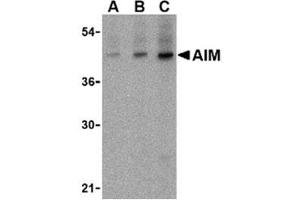 Image no. 1 for anti-CD5 Molecule-Like (CD5L) (N-Term) antibody (ABIN318737)