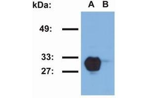 Image no. 1 for anti-Major Histocompatibility Complex, Class II, DR beta 1 (HLA-DRB1) antibody (ABIN238469)