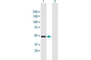 Image no. 1 for anti-Pellino Homolog 2 (Drosophila) (PELI2) (AA 1-420) antibody (ABIN949525)