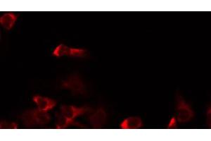 Image no. 2 for anti-Mitochondrial Ribosome Recycling Factor (MRRF) (Internal Region) antibody (ABIN6263383)