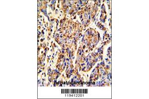 Immunohistochemistry (IHC) image for anti-Cathepsin B (CTSB) antibody (ABIN2158401)