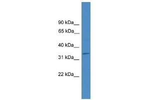 Image no. 1 for anti-ELMO/CED-12 Domain Containing 1 (ELMOD1) (Middle Region) antibody (ABIN928947)