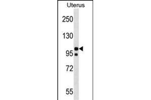 NLRP4 Antibody (N-term) (ABIN1538995 and ABIN2850178) western blot analysis in Uterus tissue lysates (35 μg/lane).