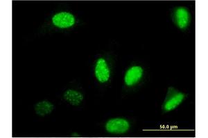 Image no. 2 for anti-Nuclear Factor I/B (NFIB) (AA 1-420) antibody (ABIN518322)