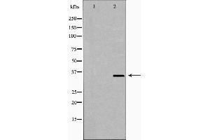 Image no. 1 for anti-Nudix (Nucleoside Diphosphate Linked Moiety X)-Type Motif 6 (NUDT6) (Internal Region) antibody (ABIN6263765)