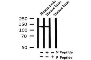 Image no. 1 for anti-Period Homolog 1 (Drosophila) (PER1) (pSer704) antibody (ABIN6267812)