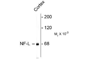 Image no. 1 for anti-Neurofilament, Light Polypeptide (NEFL) antibody (ABIN361352)
