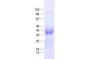 Image no. 1 for Chitinase, Acidic (CHIA) protein (His tag) (ABIN2714649)