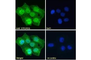 Image no. 3 for anti-General Transcription Factor II I Repeat Domain-Containing 1 (GTF2IRD1) (Internal Region) antibody (ABIN185681)