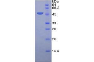 Image no. 1 for Leucine-Rich alpha-2 Glycoprotein 1 (LRG1) ELISA Kit (ABIN6730983)