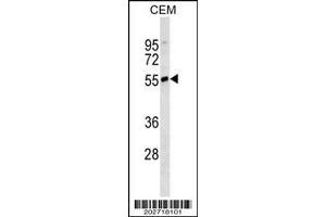 anti-IgD (AA 37-64) antibody