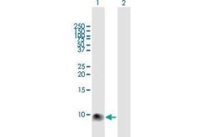Image no. 1 for anti-S100 Calcium Binding Protein A12 (S100A12) (AA 1-92) antibody (ABIN2565868)