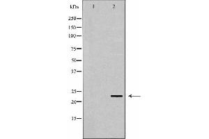 Image no. 2 for anti-CD83 (CD83) antibody (ABIN6260656)
