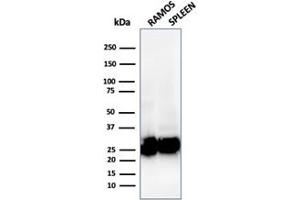 Image no. 6 for anti-MHC Class II HLA-DP/DQ/DR (HLA-DP/DQ/DR) antibody (ABIN6941388)