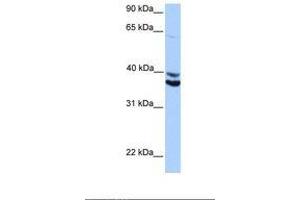 Image no. 1 for anti-MyoD Family Inhibitor Domain Containing (MDFIC) (AA 188-237) antibody (ABIN6739324)