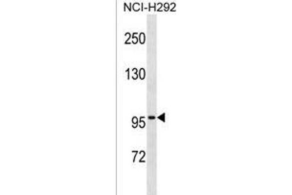 ZNF229 antibody  (N-Term)