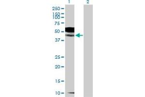 Image no. 2 for anti-Interleukin 1 Receptor, Type II (IL1R2) (AA 1-398) antibody (ABIN521668)