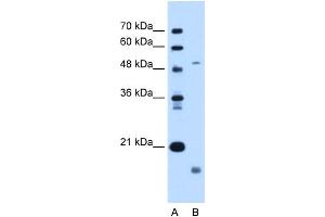 Image no. 1 for anti-Zinc Metalloproteinase, Ste24 (Zmpste24) (N-Term) antibody (ABIN2782696)