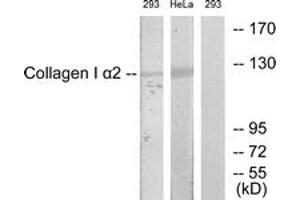 Image no. 1 for anti-Collagen, Type I, alpha 2 (COL1A2) (AA 471-520) antibody (ABIN1534337)