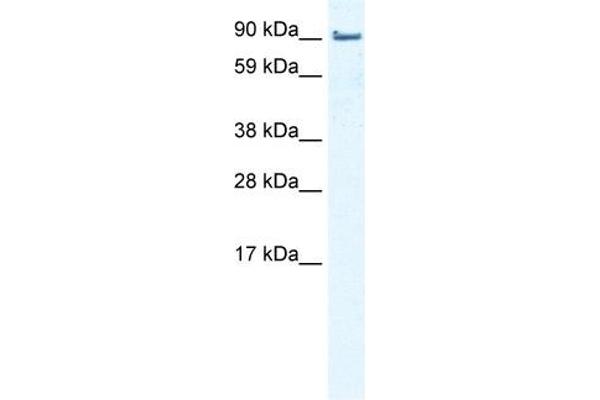 anti-LIM Domain and Actin Binding 1 (LIMA1) (Middle Region) antibody