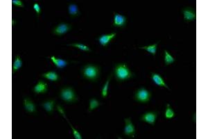 Immunofluorescence staining of SH-SY5Y cells with ABIN7165023 at 1:133, counter-stained with DAPI.