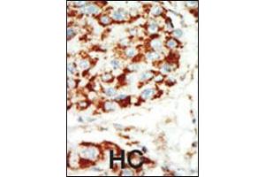Image no. 3 for anti-Protein Kinase, AMP-Activated, beta 1 Non-Catalytic Subunit (PRKAB1) (N-Term) antibody (ABIN2159100)