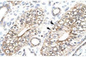 Image no. 1 for anti-MYST/Esa1-Associated Factor 6 (MEAF6) (N-Term) antibody (ABIN1108194)