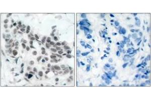 Image no. 2 for anti-Retinoblastoma Protein (Rb Protein) (AA 751-800), (pSer780) antibody (ABIN1531960)
