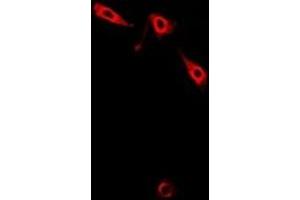 Image no. 1 for anti-LIM and Senescent Cell Antigen-Like Domains 1 (LIMS1) antibody (ABIN2966909)