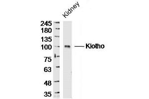 Image no. 4 for anti-Klotho (KL) (AA 401-500) antibody (ABIN681778)