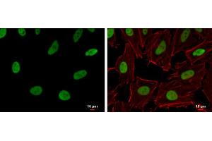 Image no. 4 for anti-RecQ Protein-Like (DNA Helicase Q1-Like) (RECQL) (N-Term) antibody (ABIN2857056)