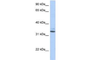 SULT1A1 antibody  (N-Term)