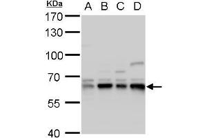 WB Image Copine I antibody [N3C3] detects Copine I protein by western blot analysis.