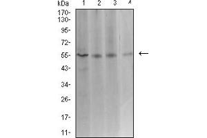 Image no. 3 for anti-ASF1 Anti-Silencing Function 1 Homolog B (ASF1B) (AA 1-202) antibody (ABIN5611237)