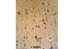 Image no. 1 for anti-Zinc Finger, DHHC-Type Containing 9 (ZDHHC9) (AA 335-364), (C-Term) antibody (ABIN955656)