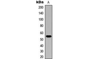 Image no. 2 for anti-Cytochrome P450, Family 21, Subfamily A, Polypeptide 2 (CYP21A2) (Center) antibody (ABIN2705979)
