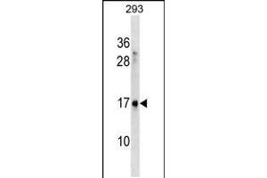 Image no. 1 for anti-SYS1 Golgi-Localized Integral Membrane Protein Homolog (SYS1) (AA 125-153), (C-Term) antibody (ABIN5538832)