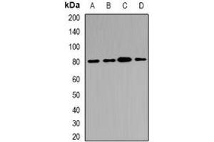Image no. 2 for anti-ATP-Binding Cassette, Sub-Family B (MDR/TAP), Member 8 (ABCB8) (full length) antibody (ABIN6043104)