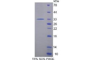 Image no. 1 for Protein tyrosine Phosphatase, Receptor Type, H (PTPRH) (AA 551-802) protein (His tag) (ABIN6238145)
