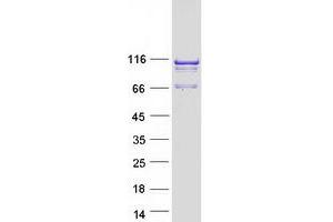 Image no. 1 for Sperm Associated Antigen 1 (SPAG1) (Transcript Variant 1) protein (Myc-DYKDDDDK Tag) (ABIN2732486)