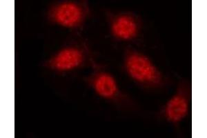 Image no. 12 for anti-GATA Binding Protein 4 (GATA4) (pSer262) antibody (ABIN6256227)