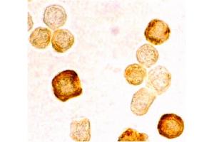Image no. 2 for anti-CASP8 and FADD-Like Apoptosis Regulator (CFLAR) (C-Term) antibody (ABIN6655307)