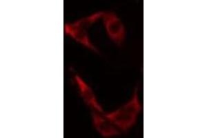 Image no. 1 for anti-Transforming, Acidic Coiled-Coil Containing Protein 3 (TACC3) (C-Term) antibody (ABIN6258335)